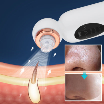 HexoSkin™ Hydrodermabrasion borttagare av pormaskar