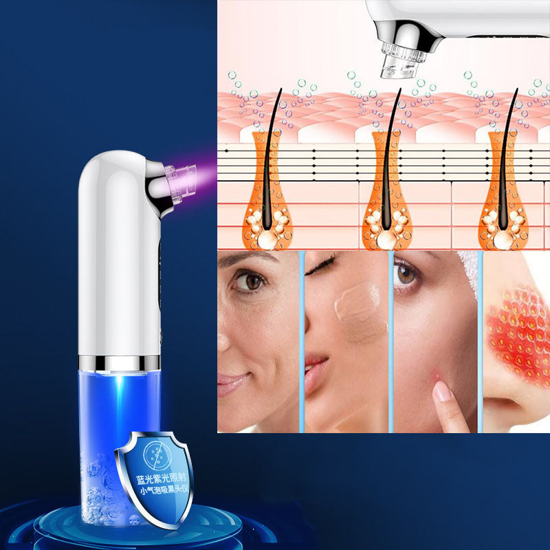 HexoSkin™ Microdermabrasion djuprengörande pormaskborttagare