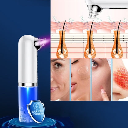 HexoSkin™ Microdermabrasion djuprengörande pormaskborttagare