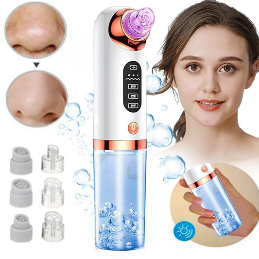HexoSkin™ Microdermabrasion djuprengörande pormaskborttagare