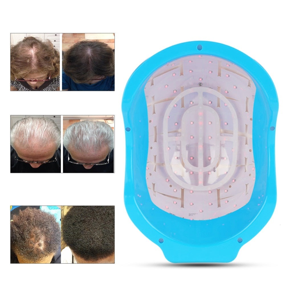 HexoGrow™ - Laserhjälm för håråterväxt