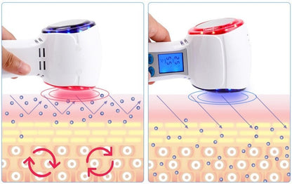 HexoCryo™ Kryoterapiapparat för ansiktet